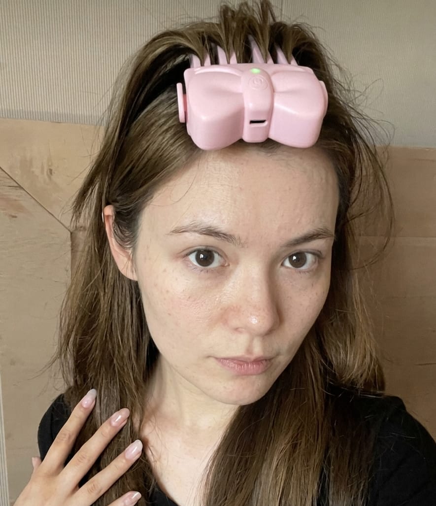 Customer photo review of Revimus Heated Root Volumizer Clip
