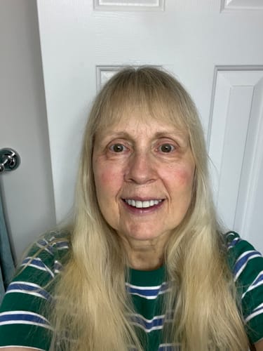 Customer's smiling portrait showing skin texture after using the Seranova Micro Infusion System.