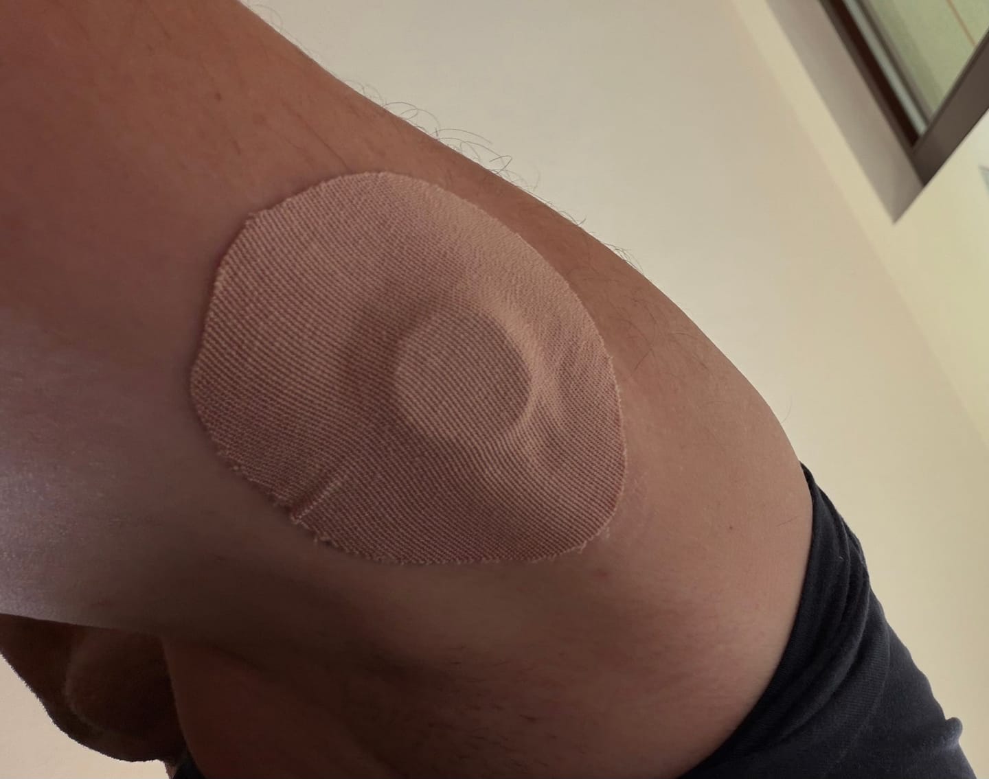 Customer photo review of Skin Grip Original - Dexcom G7 & Stelo Adhesive Patches