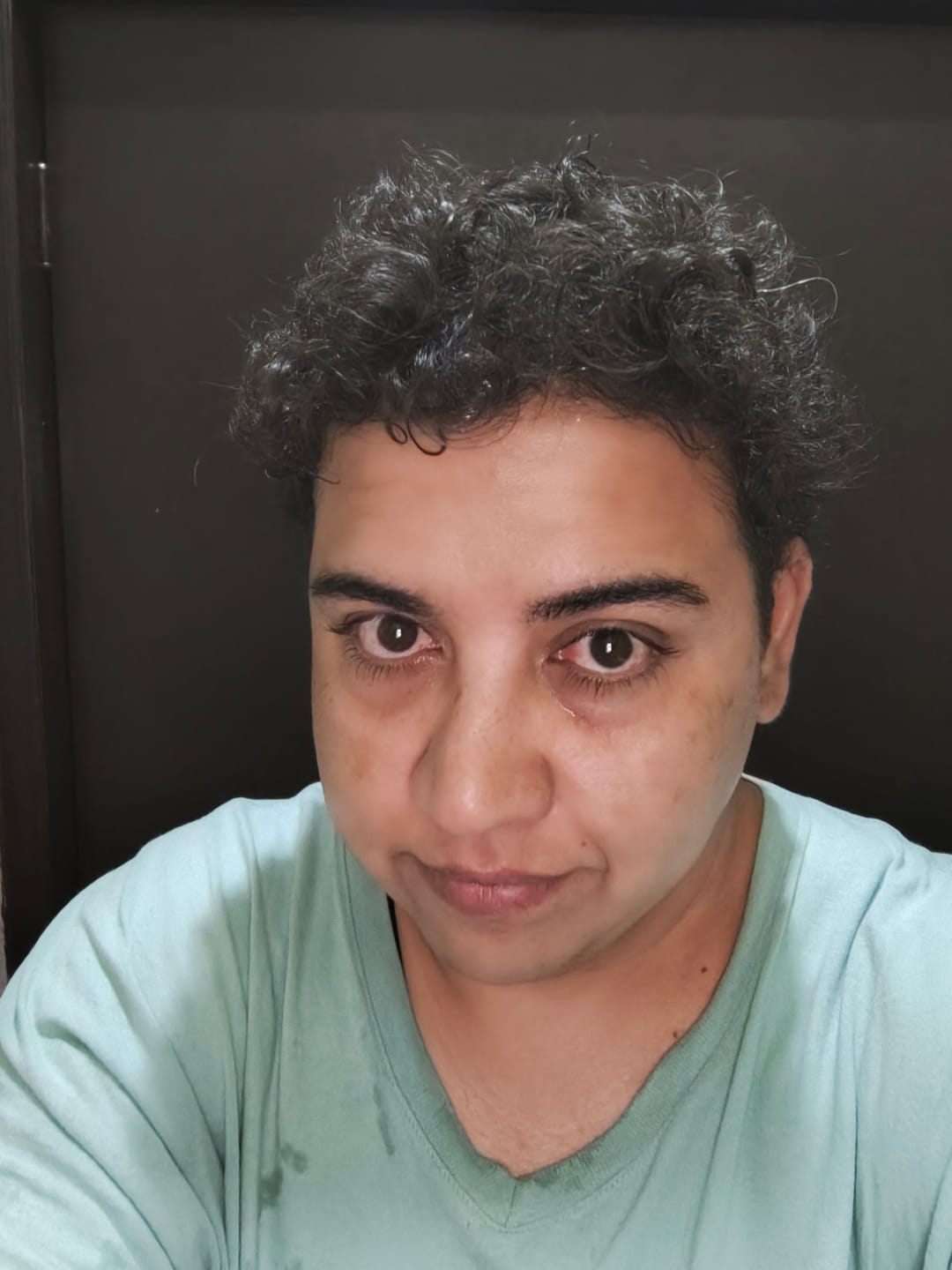 Customer photo review of Minoxidil 5 mg con 90 tabletas para 3 meses de tratamiento