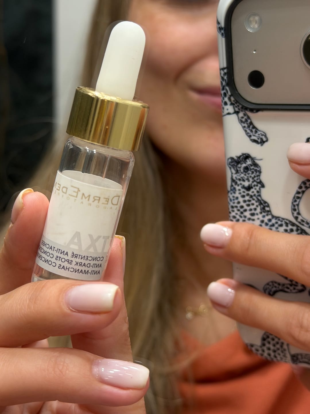 Customer photo review of DERMEDEN TXA 5% ANTI-DARK SPOTS CONCENTRATE - koncentratas mažinti pigmentaciją