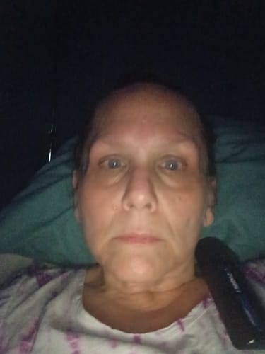 Reviewer showing their face while holding the Seranova Micro Infusion System device.