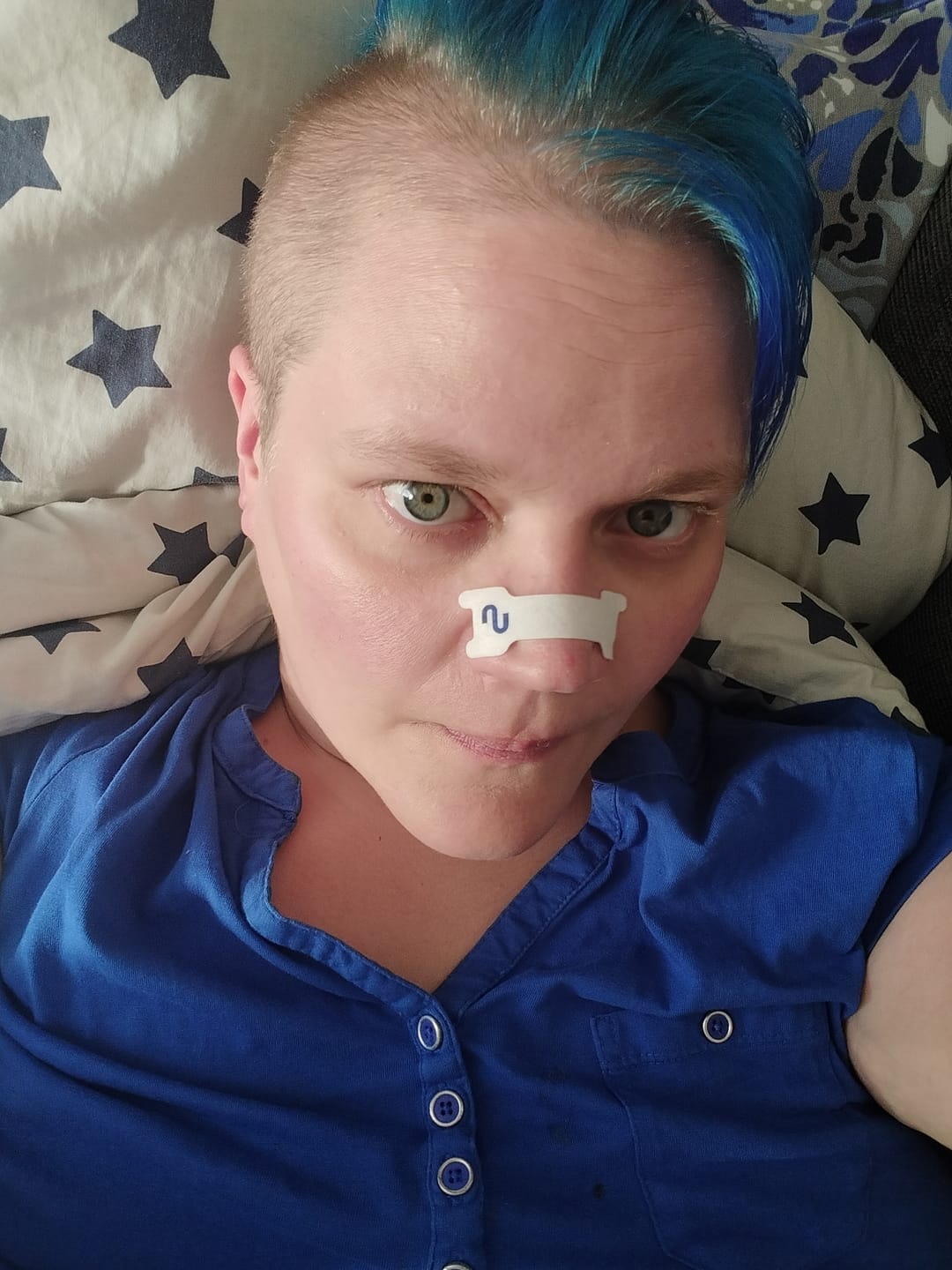 Customer photo review of Nuku Sleep Nasal Strips