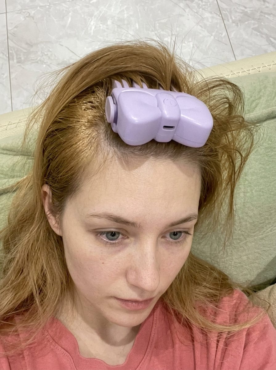 Customer photo review of Revimus Heated Root Volumizer Clip