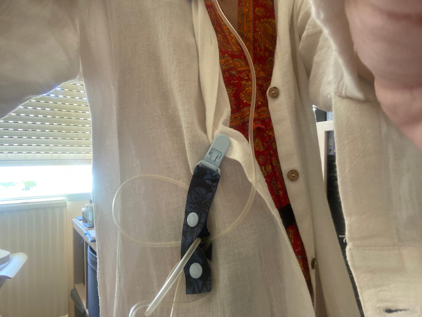 Customer photo review of Medical Tube Fixation Clip for Adults (S, M, L or Set) | Kaio-Tube Clip