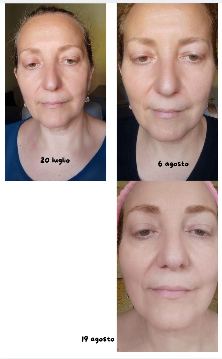 Customer photo review of BioChroma – Siero Coreano Effetto Lifting dalla Prima Applicazione
