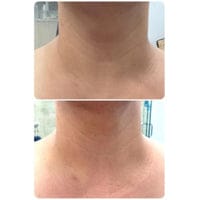 Customer photo review of Naperi™ Crema Age Reset