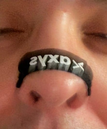 Customer photo review of Axys Trake za Nos