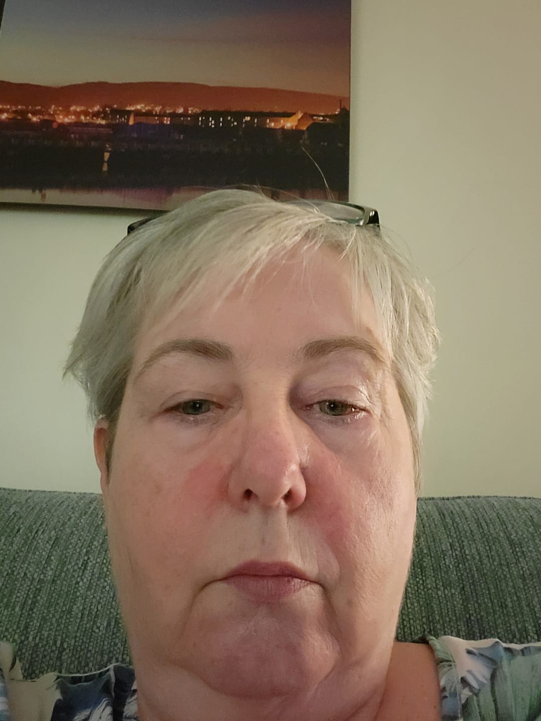 Customer photo review of SPF Duo - LIMITED TIME OFFER