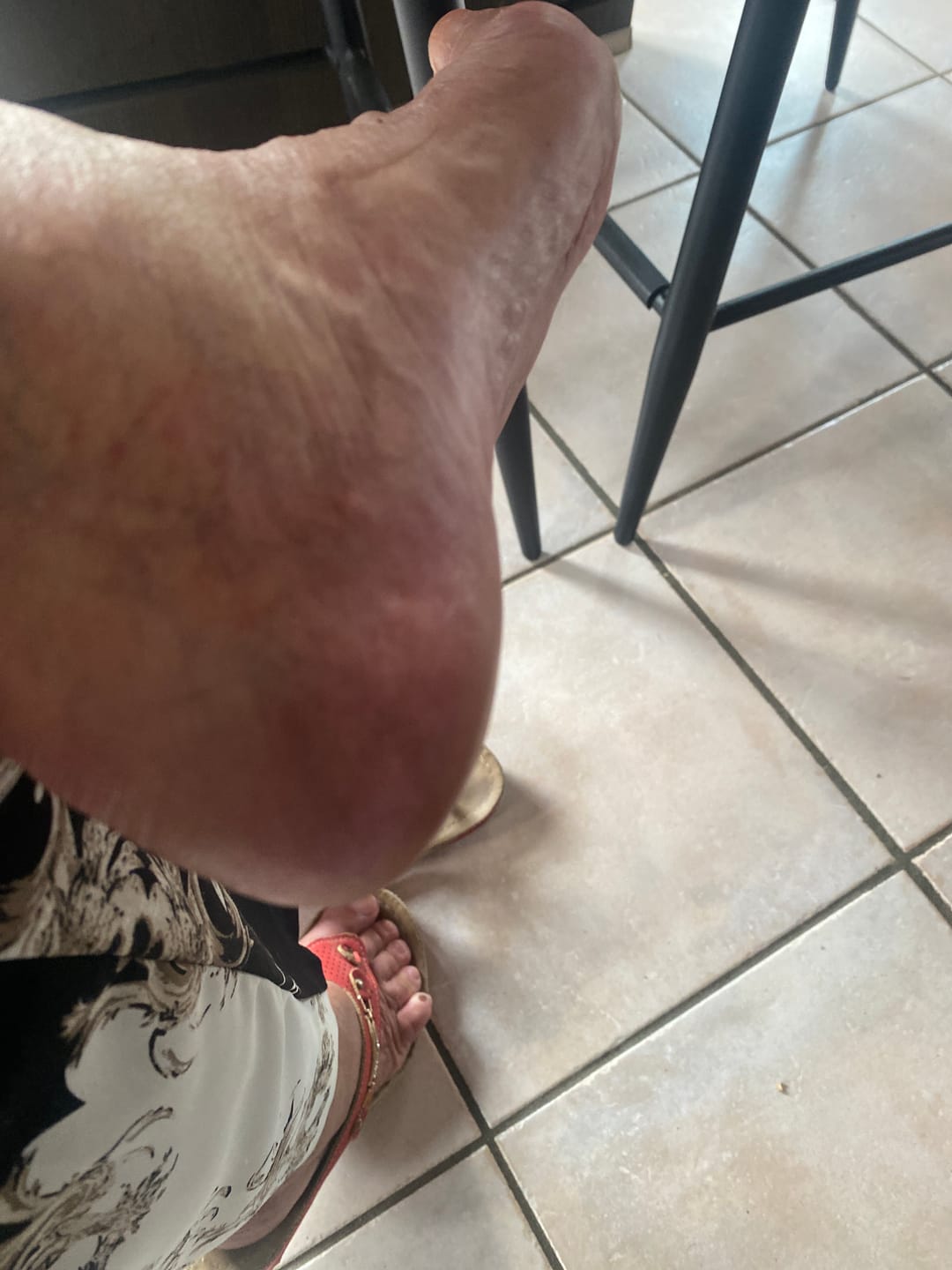 Customer photo review of ✨ HoneyGlow™ – Kit Beauté Pieds