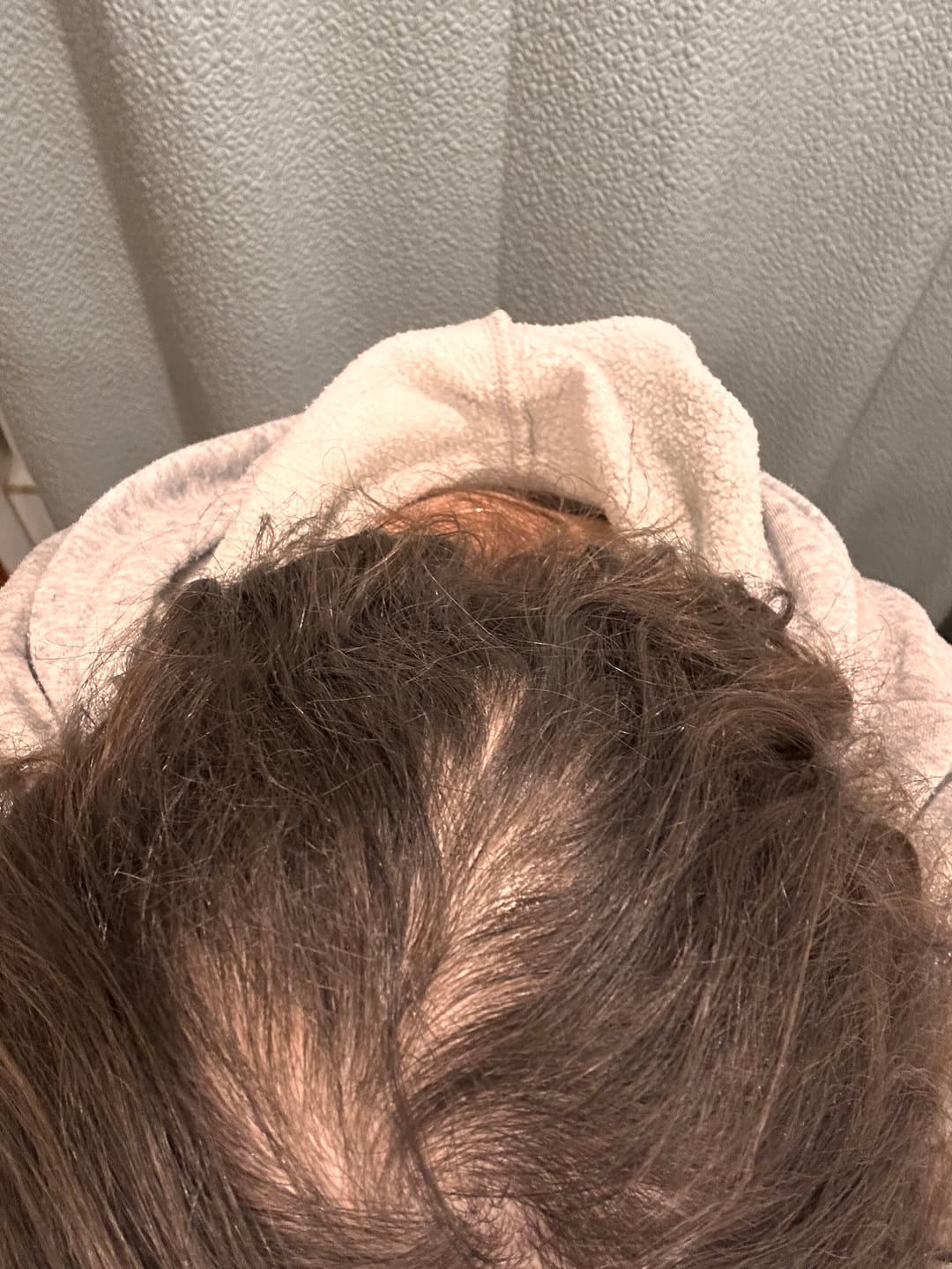 Customer photo review of Tónico Anticaída