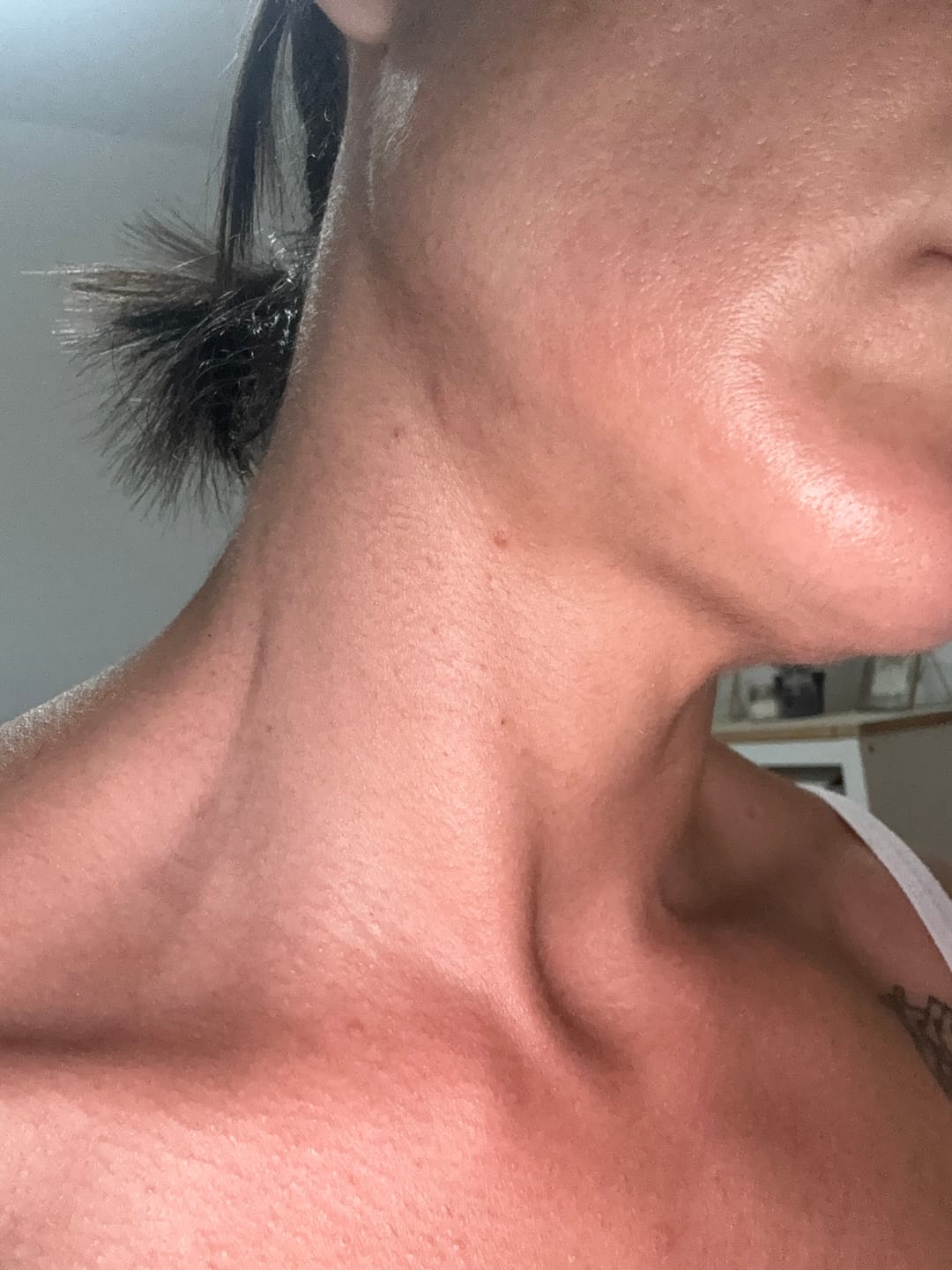 Customer photo review of A CONTROL - ACNÉ HORMONAL & RESISTENCIA A LA INSULINA