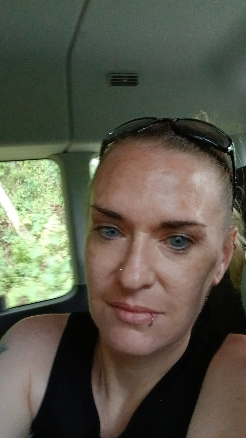 Customer photo review of Clover Blue Prescription Colored Contact Lenses