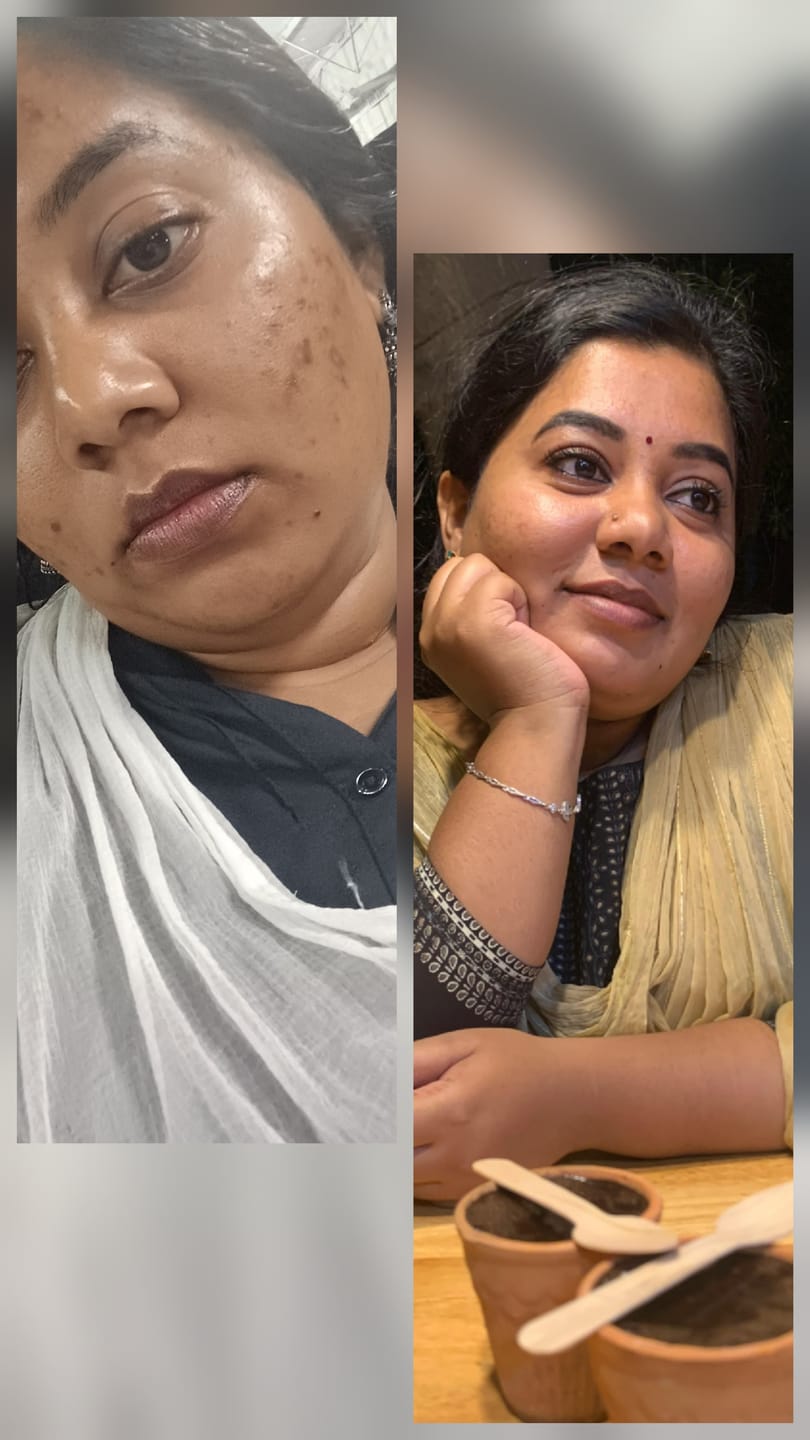 Customer photo review of Turmeric Night Repair Cream