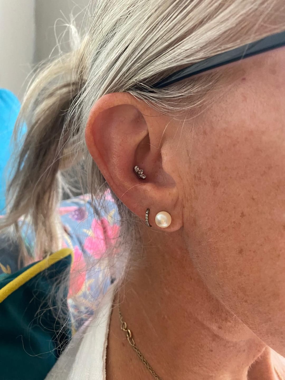 Customer photo review of Junipurr Titanium Flatback Labret Threadless