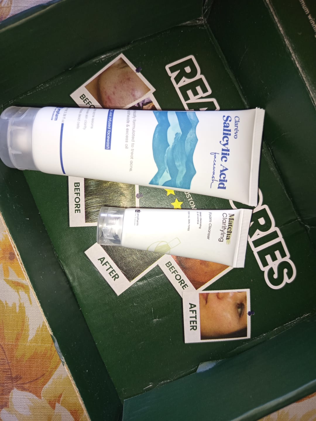 Customer photo review of Clarevo Salicylic Acid Facewash