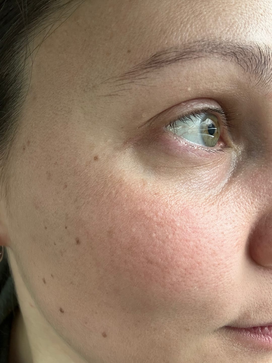 Customer photo review of Ceramide + Caffeine Ageless Eye Serum