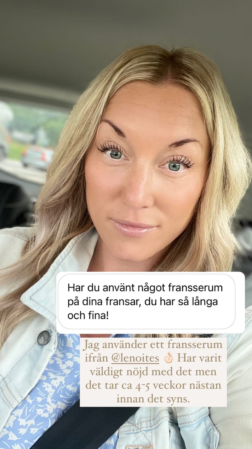 Customer photo review of Eyelash Growth Serum