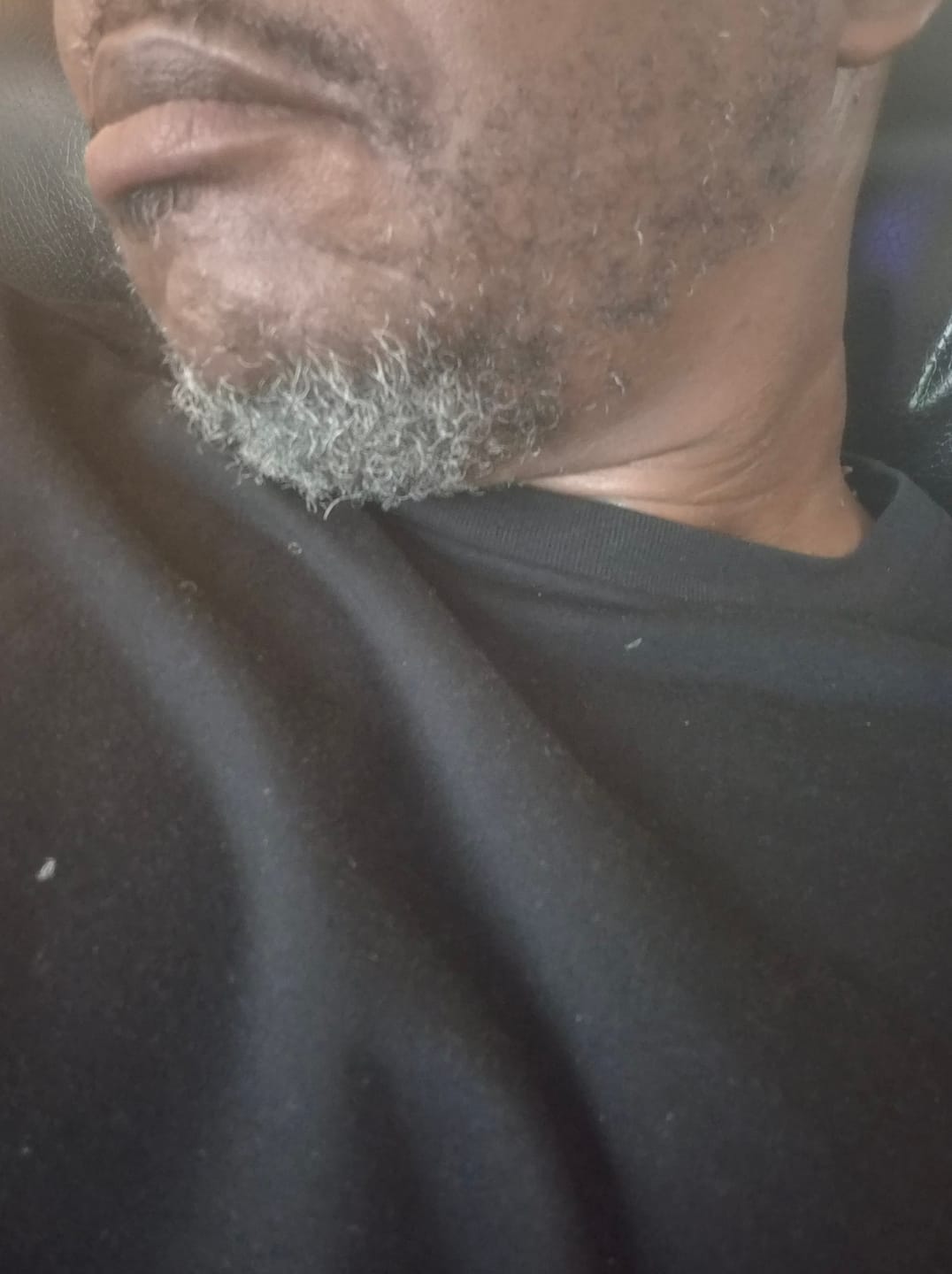 Customer photo review of Beard Care Kit