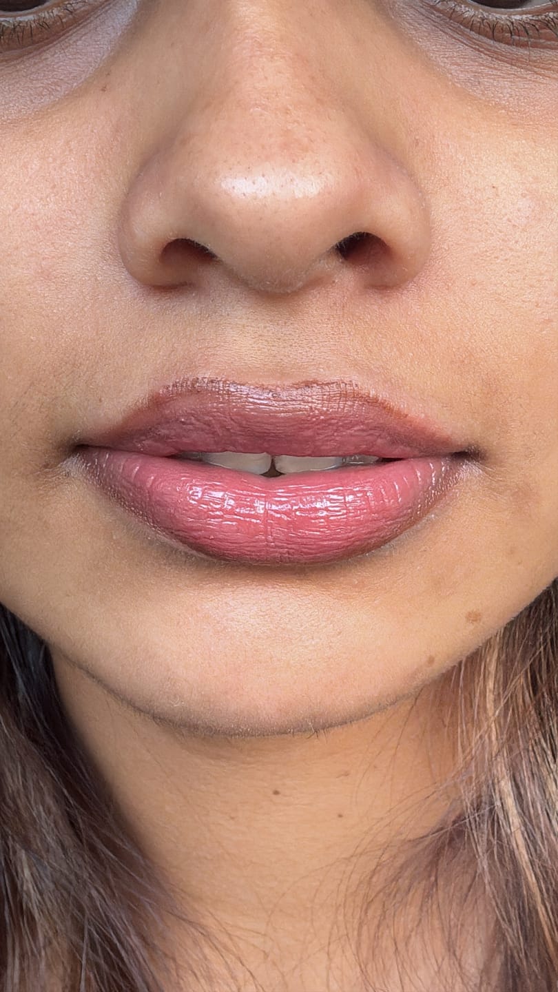 Customer photo review of Extreme Lip Plumper