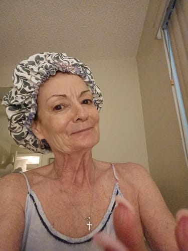 Customer's portrait wearing a patterned sleep cap after using the Seranova Micro Infusion System.