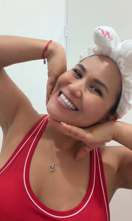 Customer photo review of Dentéa™ V34 — Blanqueamiento Dental en Casa