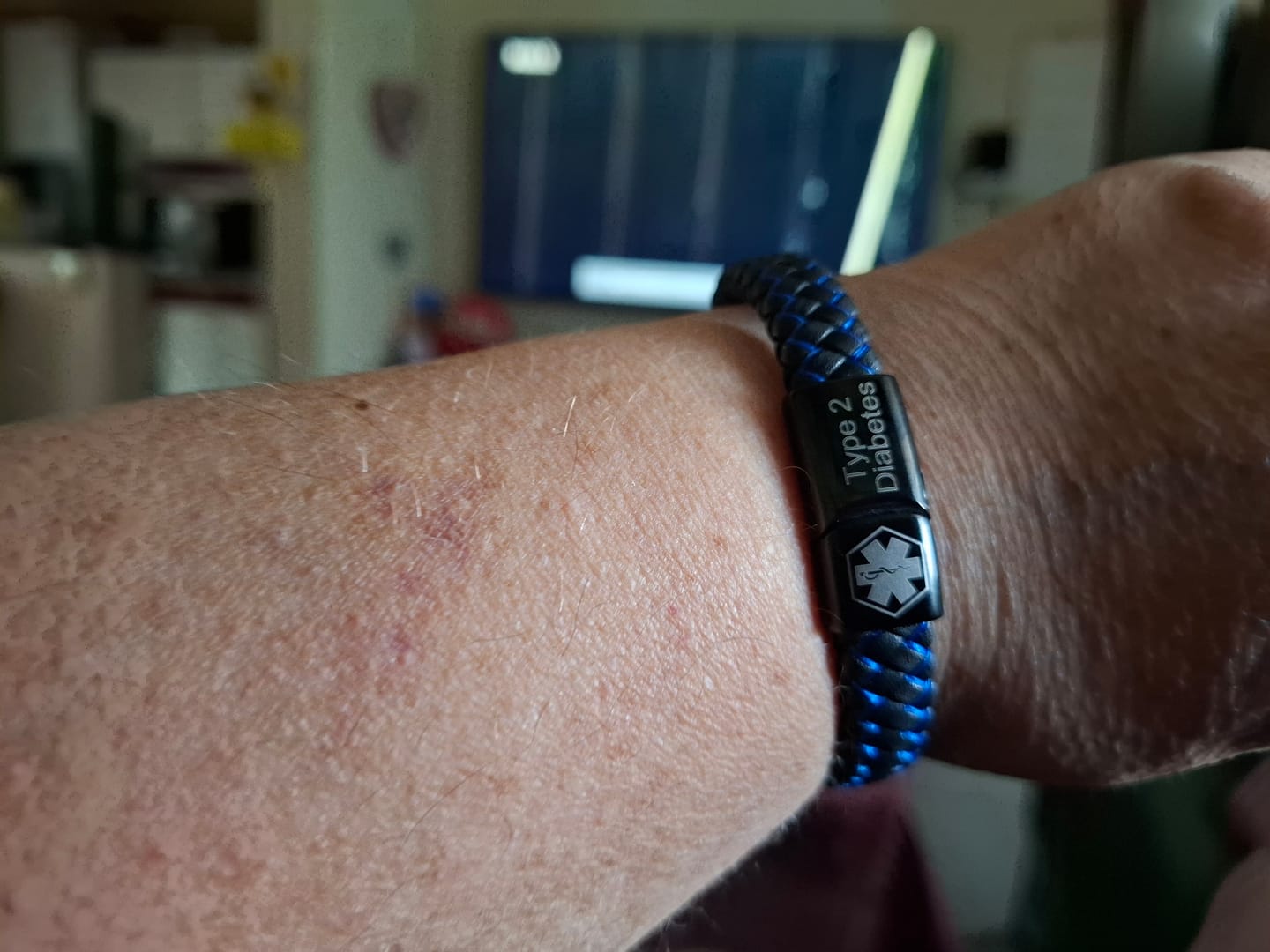 Customer photo review of Medizinisches Notfallarmband