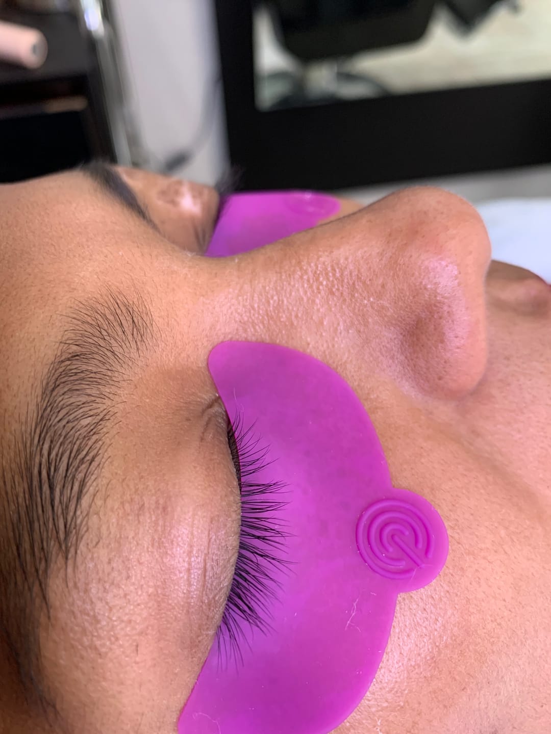 Customer photo review of Silicon Eye Patch - Maxymova