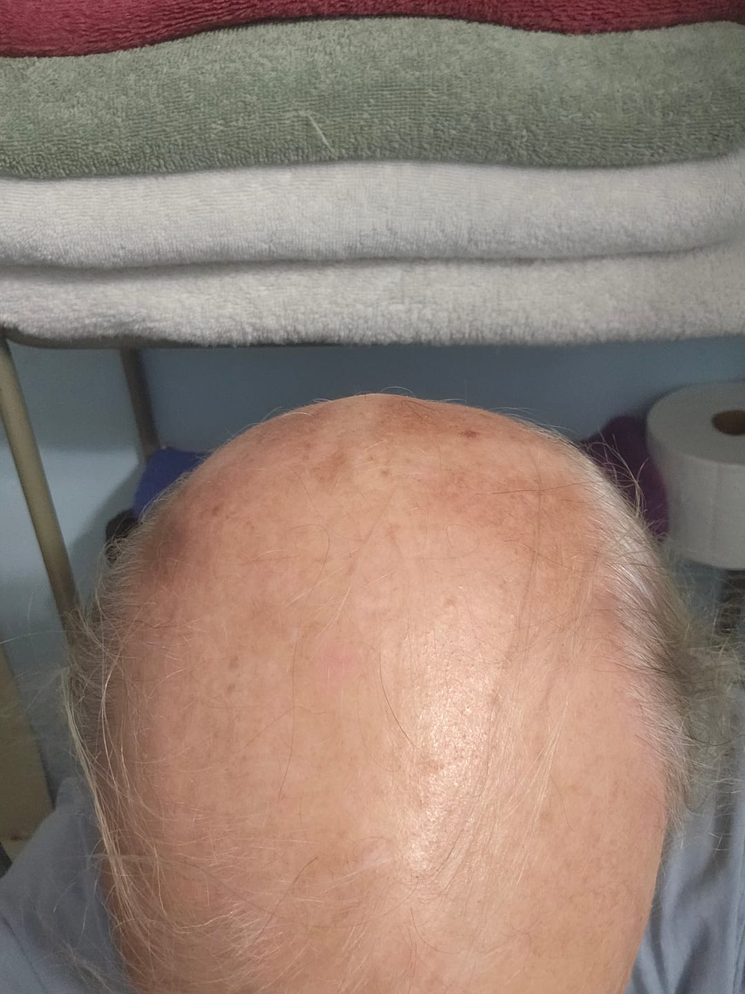 Customer photo review of SPARTAN™ - Root Activator Shampoo