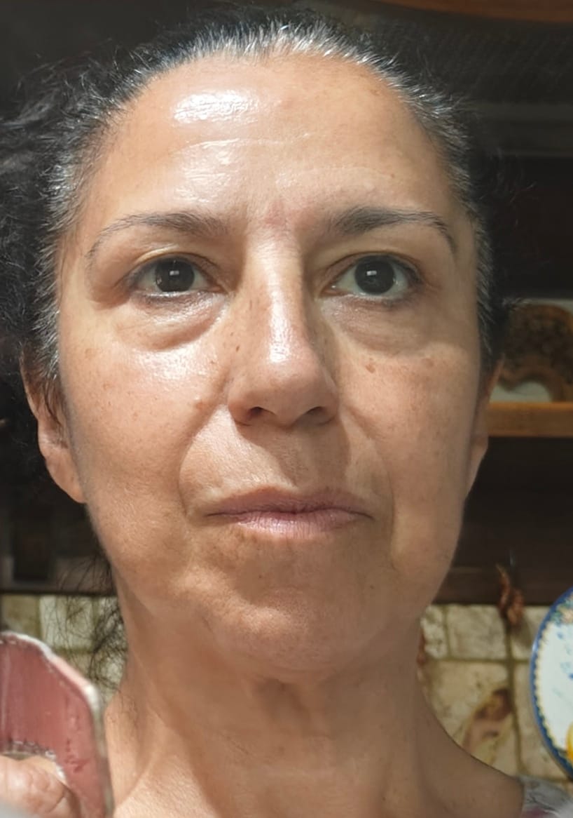 Customer photo review of BioChroma – Siero Coreano Effetto Lifting dalla Prima Applicazione