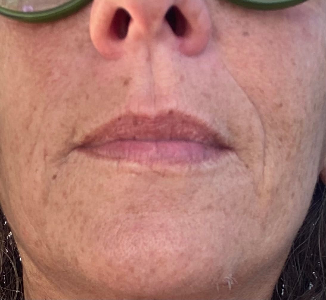 Customer photo review of Siero Luminosità Immediata PDRN - Skin Care Coreana Biochroma