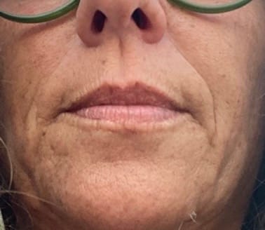 Customer photo review of BioChroma – Siero Coreano Effetto Lifting dalla Prima Applicazione