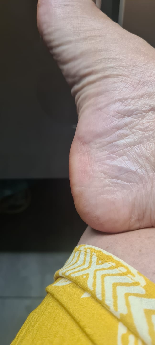 Customer photo review of ✨ HoneyGlow™ – Kit Beauté Pieds