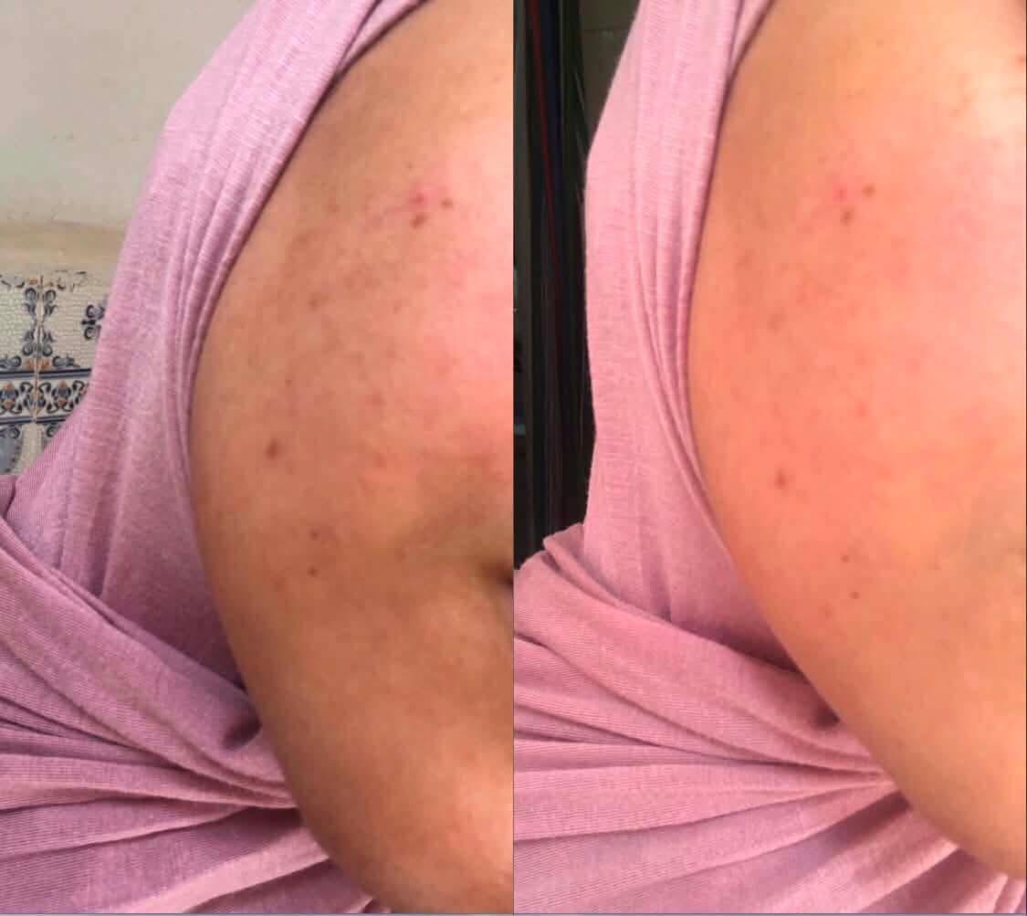 Customer photo review of Gel Nettoyant Purifiant Visage