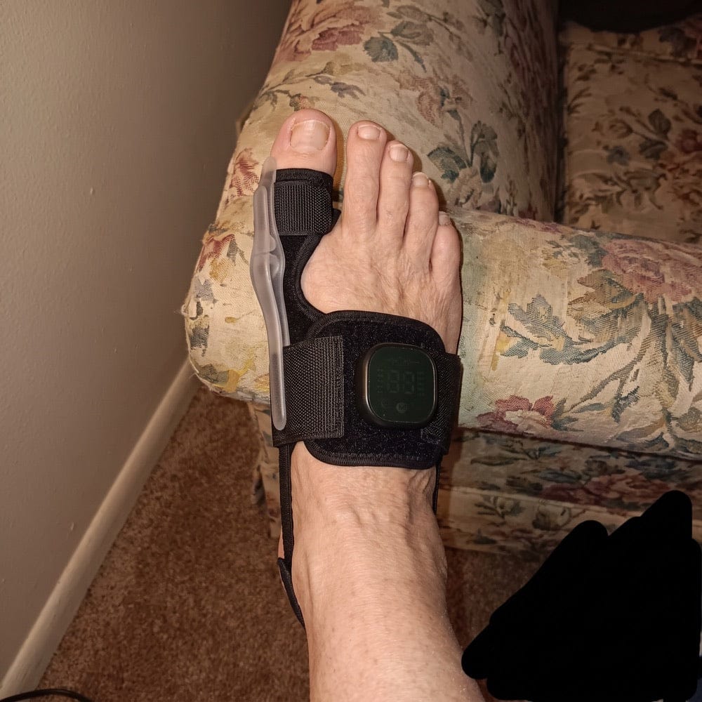 Customer photo review of Correcteur Pied Confort – Retrouvez une marche plus agréable au quotidien