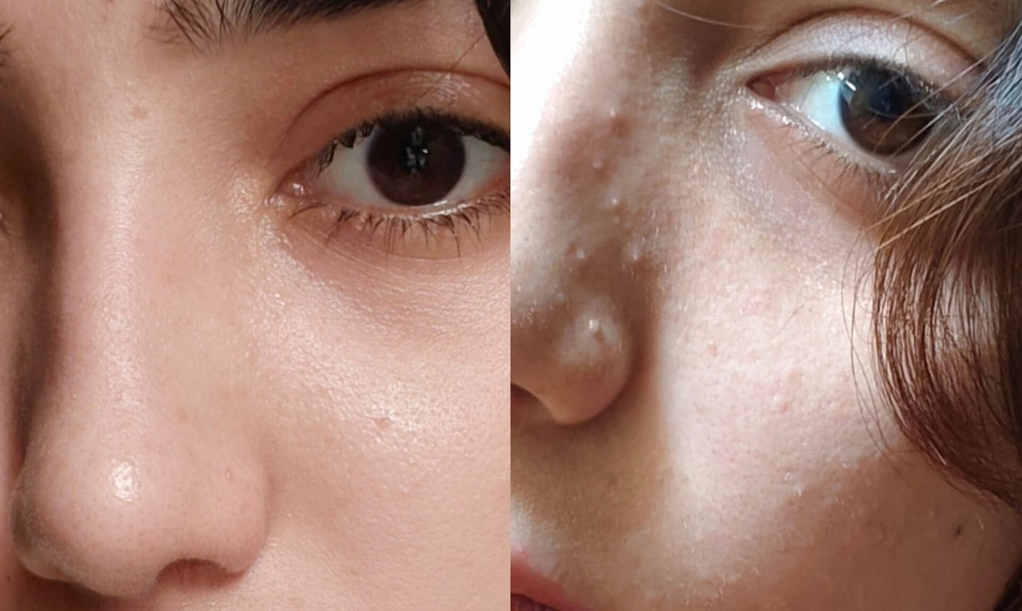 Customer photo review of Skin Rescue Mist