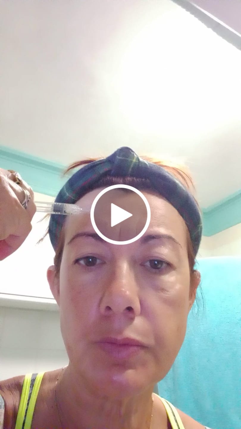 Customer video review of BioChroma – Siero Coreano Effetto Lifting dalla Prima Applicazione