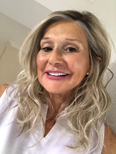 Customer photo review of [PRE-ORDER] JBEXTENSION 16 Inches Mix Blonde Curly Pre-Cut Side Part Snowflake Lace Frontlace Glueless Wig JESSICA【BENDY EAR TABS】
