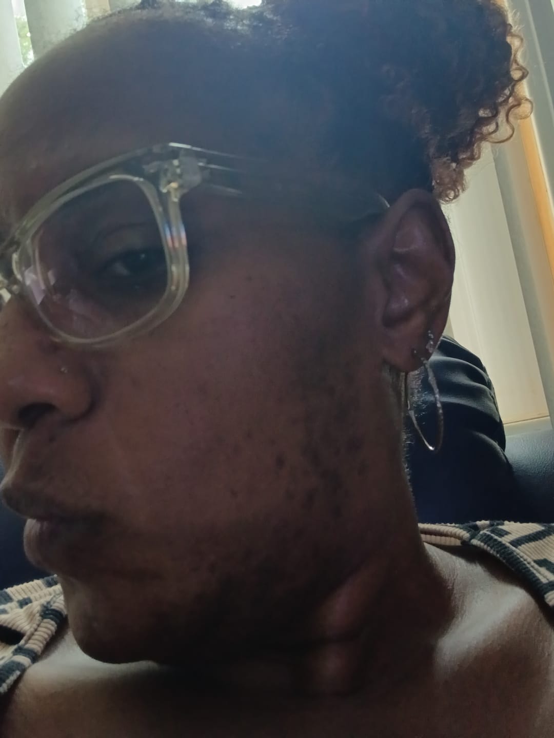 Customer photo review of Liquid African Black Soap Face Wash