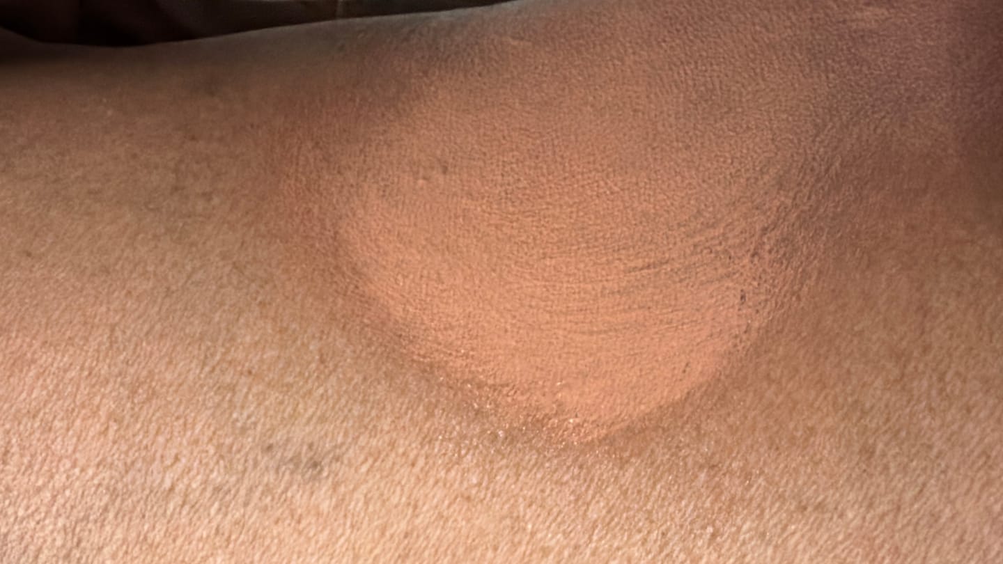 Customer photo review of Shimma™ Black Seed Oil Body Coverage Perfector