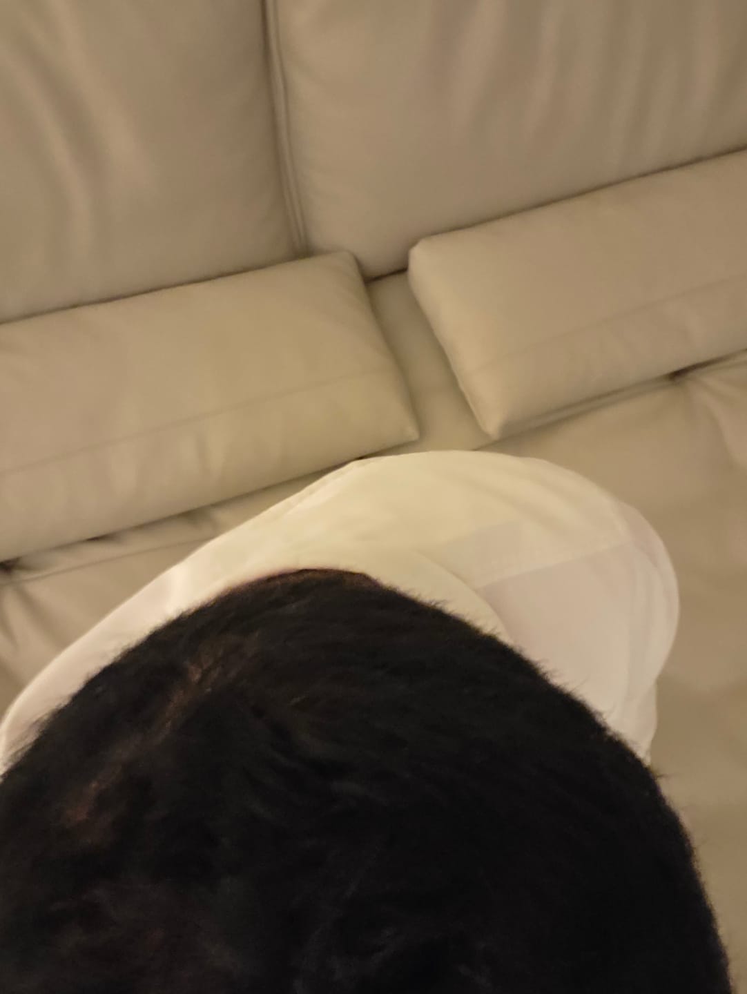 Customer photo review of Combo de Minoxidil 5 mg + Dutasterida 0.5 mg  90 tabletas c/u para 3 meses de tratamiento