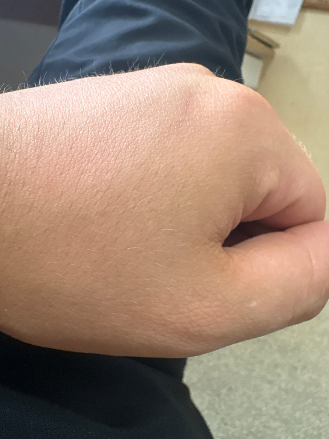 Customer photo review of Tallow Gesichtscreme® 50ml