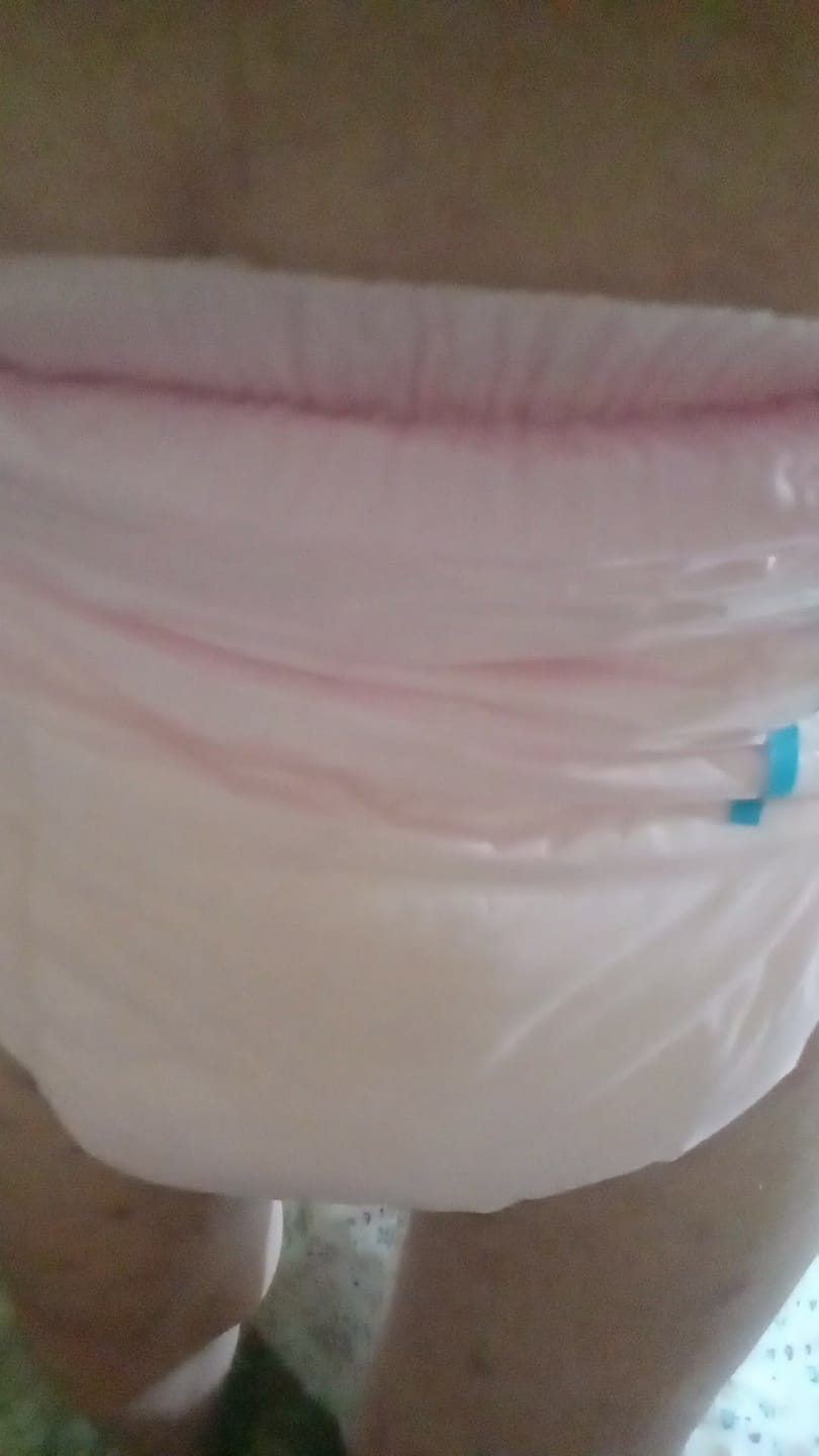 Customer photo review of SUNKISS Masterpiece Adult Diapers With Tabs