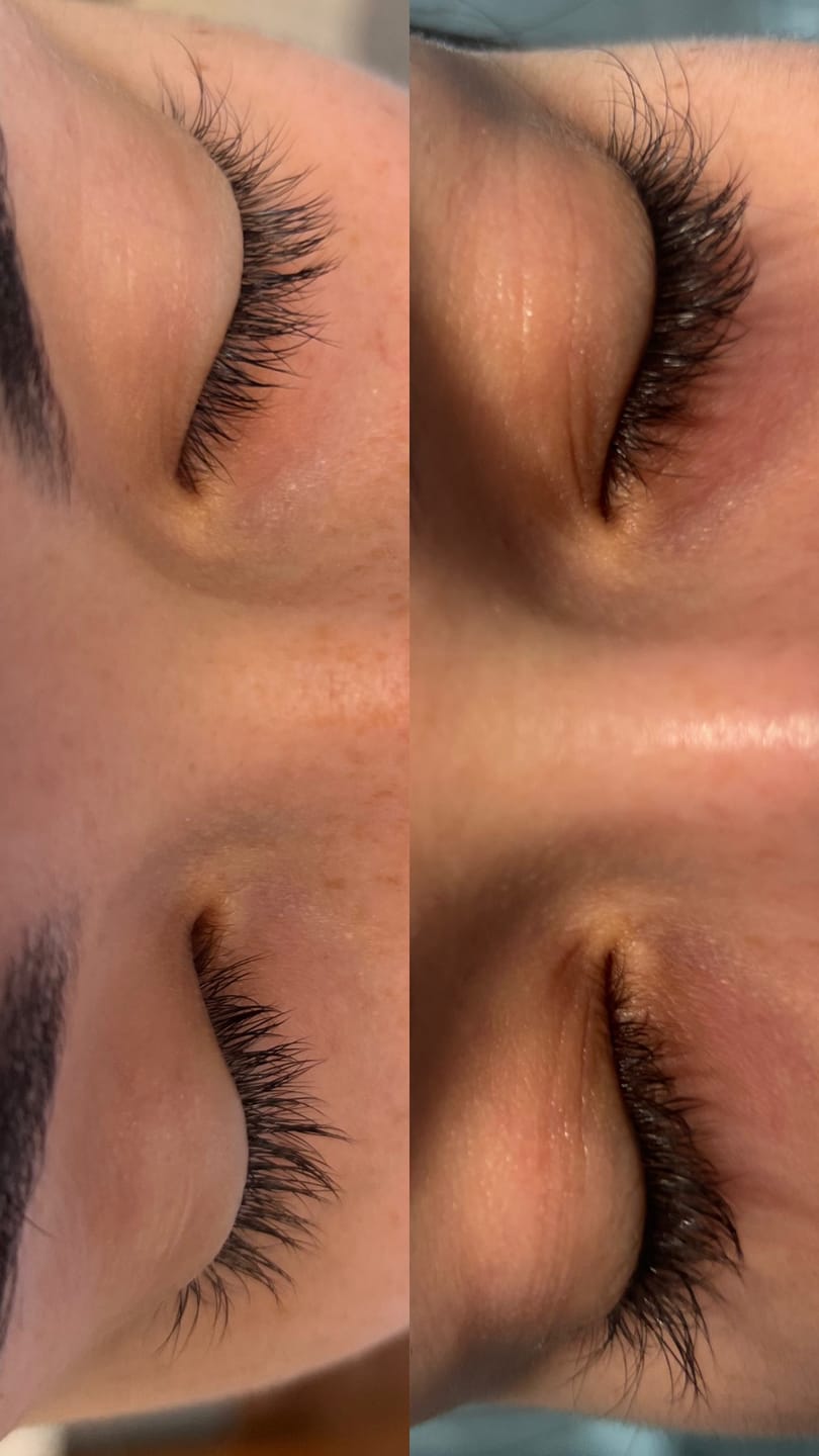 Customer photo review of KosmaLash Sérum | Crecimiento & Anticaída