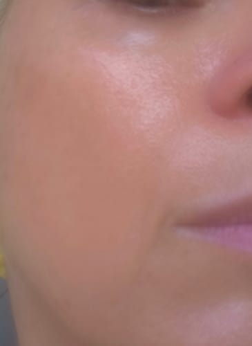 Recensione con foto di un cliente su BioChroma – Siero Coreano Effetto Lifting dalla Prima Applicazione