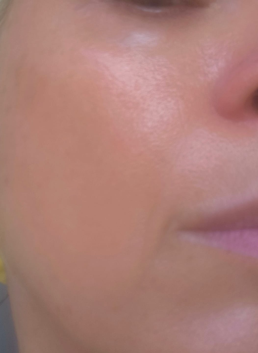 Customer photo review of BioChroma – Siero Coreano Effetto Lifting dalla Prima Applicazione