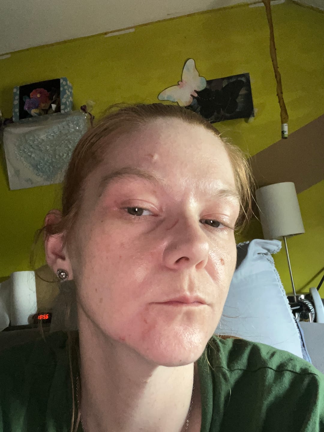 Customer photo review of Bio-Collageen Masker + Kwast