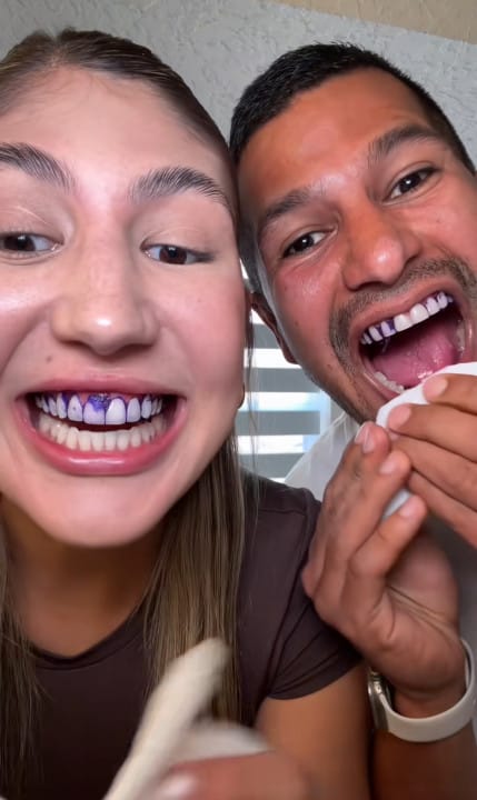 Customer photo review of Dentéa™ V34 — Blanqueamiento Dental en Casa