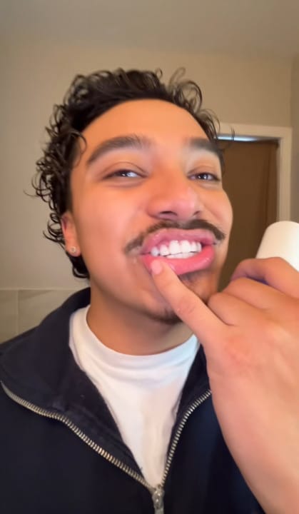 Customer photo review of Dentéa™ V34 — Blanqueamiento Dental en Casa