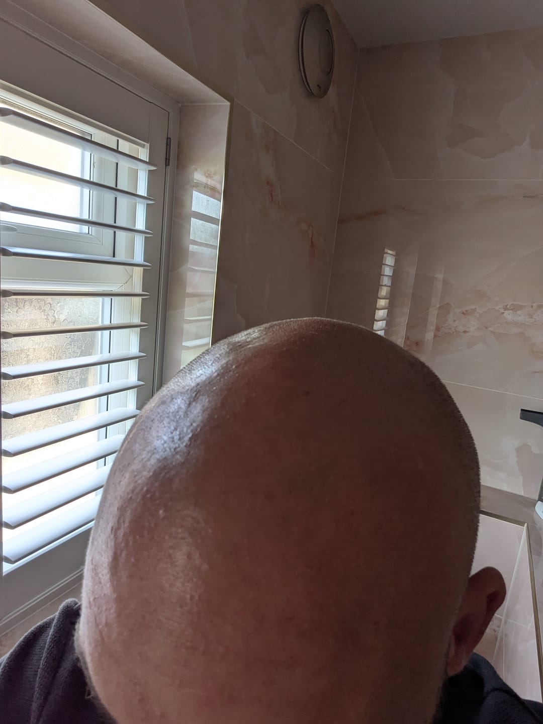 Customer photo review of Seb Natural Calming Serum